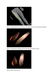 Use of a virtual 3D anterolateral thigh model in medical education: Augmentation and not replacement of traditional teaching?