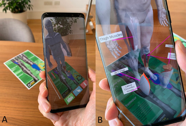 Future Directions in Digital Anatomical Simulation and Visualisation